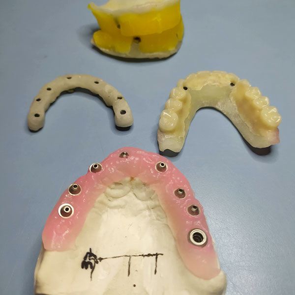 laboratorio dental en Mataró y Maresme | Laboratorio Dental Aranguren