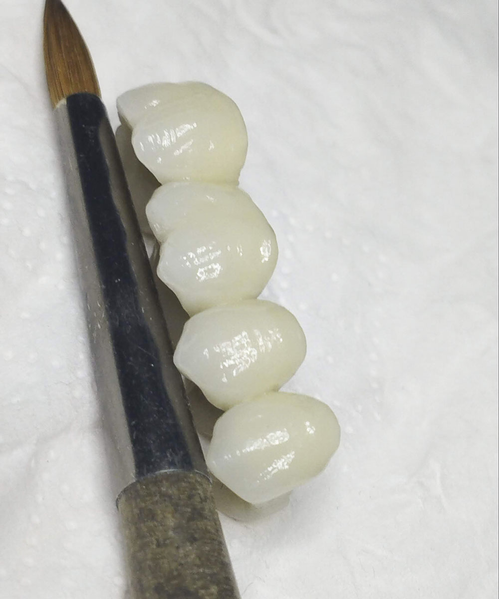 Servicios laboratorio dental en argentona | Laboratorio Dental Aranguren