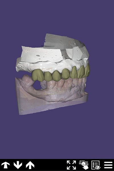 tecnologia CAD CAM | laboratori dental Aranguren a Argentona