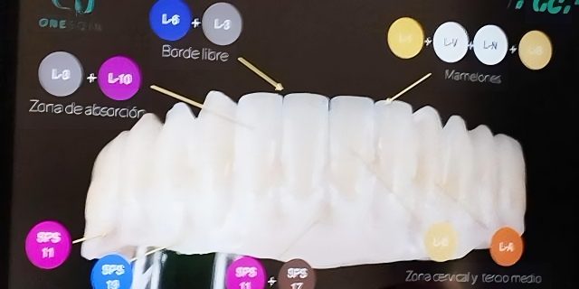 Contacto Laboratori Dental Aranguren Argentona